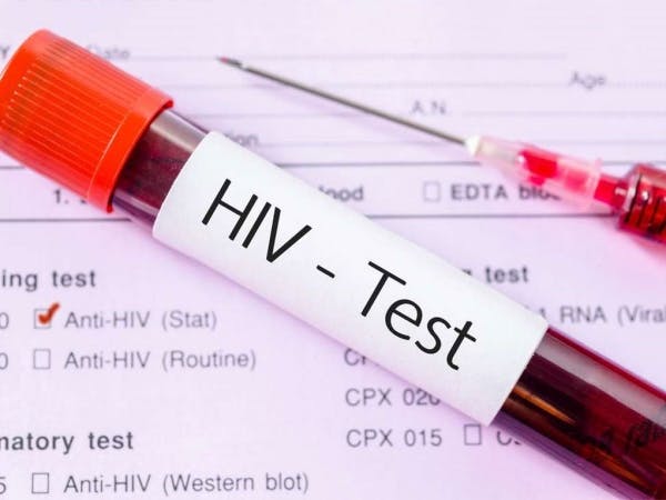 É possível exigir teste de HIV para contratação de funcionário?